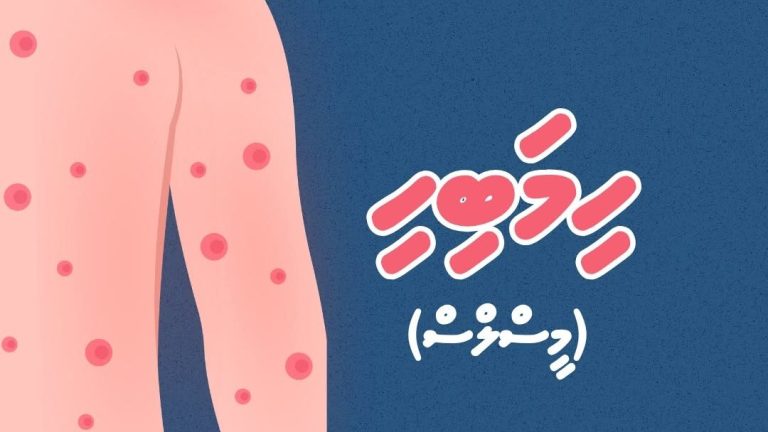 އައިސޮލޭޝަން ފެސިލިޓީއެއް ނެތުމުން ހިމަބިހި ކޮންޓްރޯލްކުރުމަށް ބޮޑު ގޮންޖެހުމެއް!